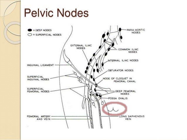 swollen vaginal lymph node Asian pussys squirt
